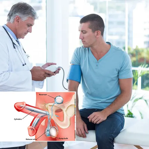 Caring for Your Penile Implant at Home