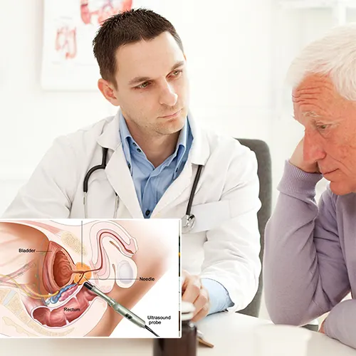 Choose  UroPartners, LLC

for Your Penile Implant Journey