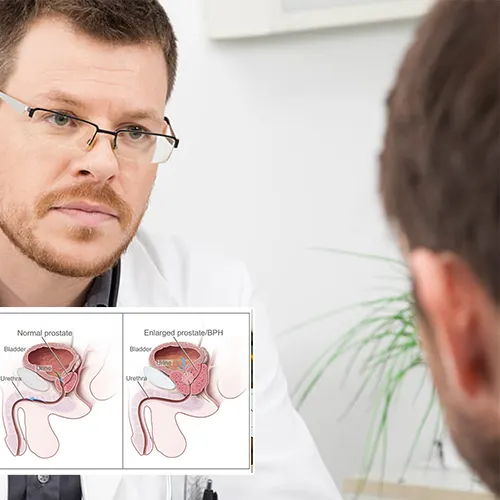 How to Choose the Right Surgeon for Your Penile Implant